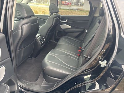 2021 Acura RDX Technology Package